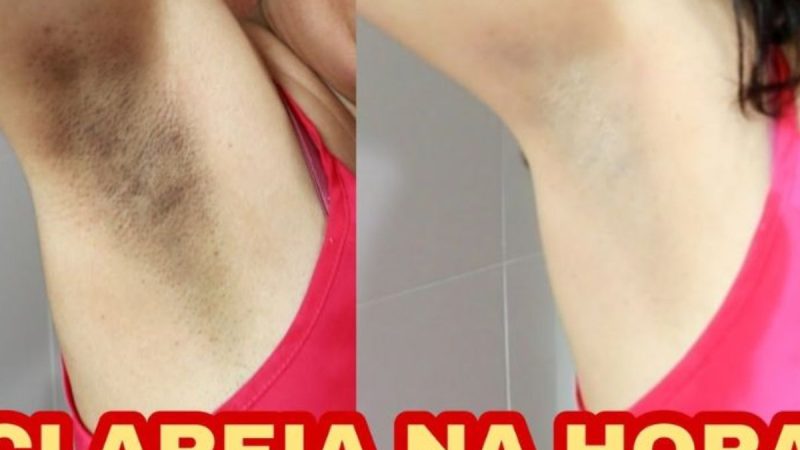 Receita para Clarear Axilas e Virilha em 5 Minutos: O Segredo para uma Pele Uniforme e Radiante